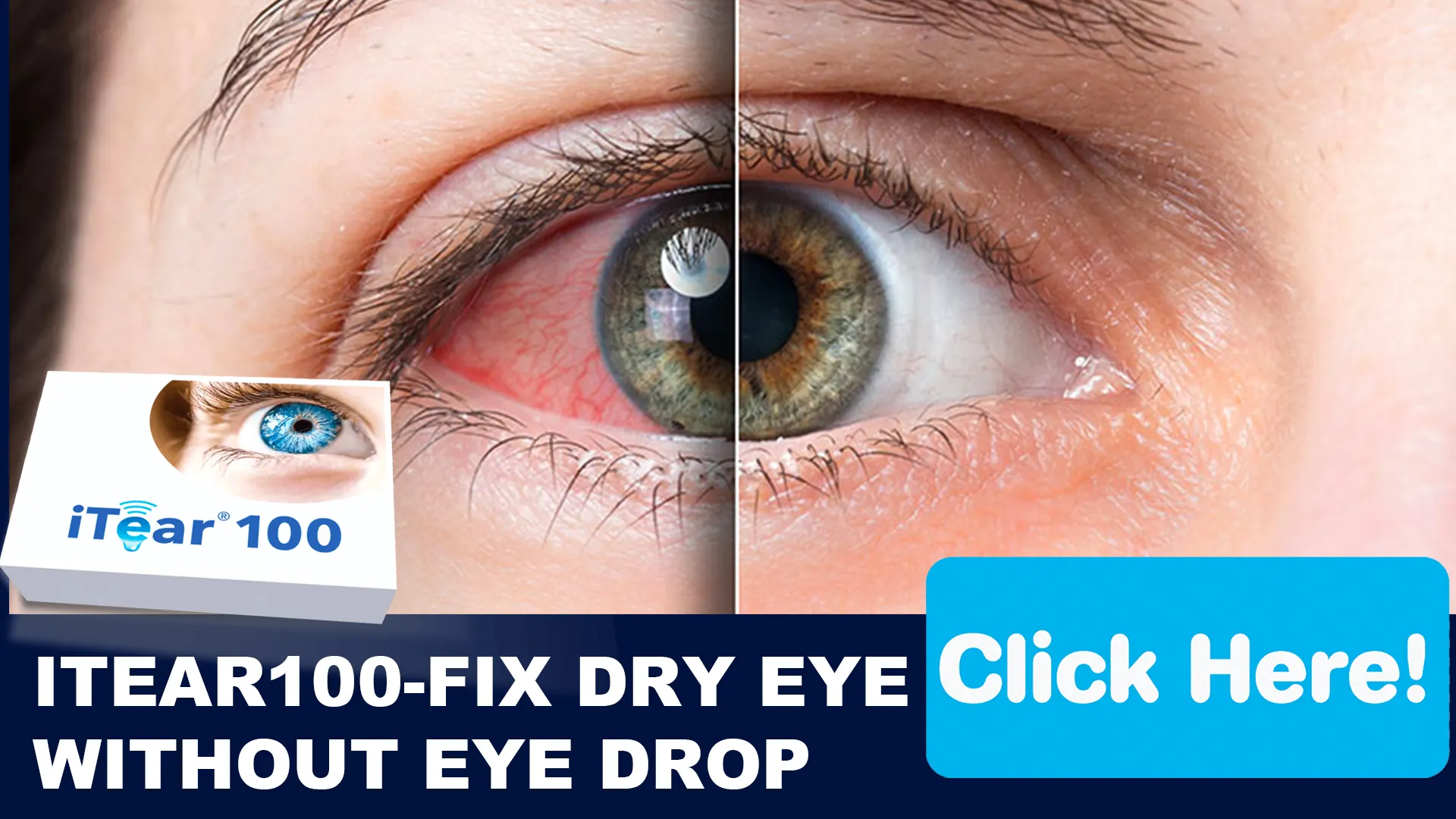 Dry Eye Syndrome: The Blinking Nuisance Omega-3 Can Tackle